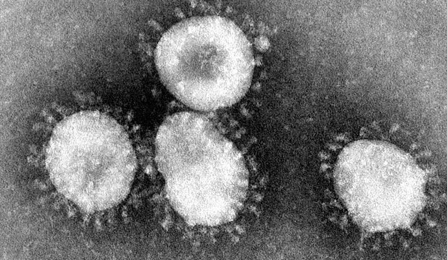 新型コロナウイルスから学ぶべきこと。（その１）